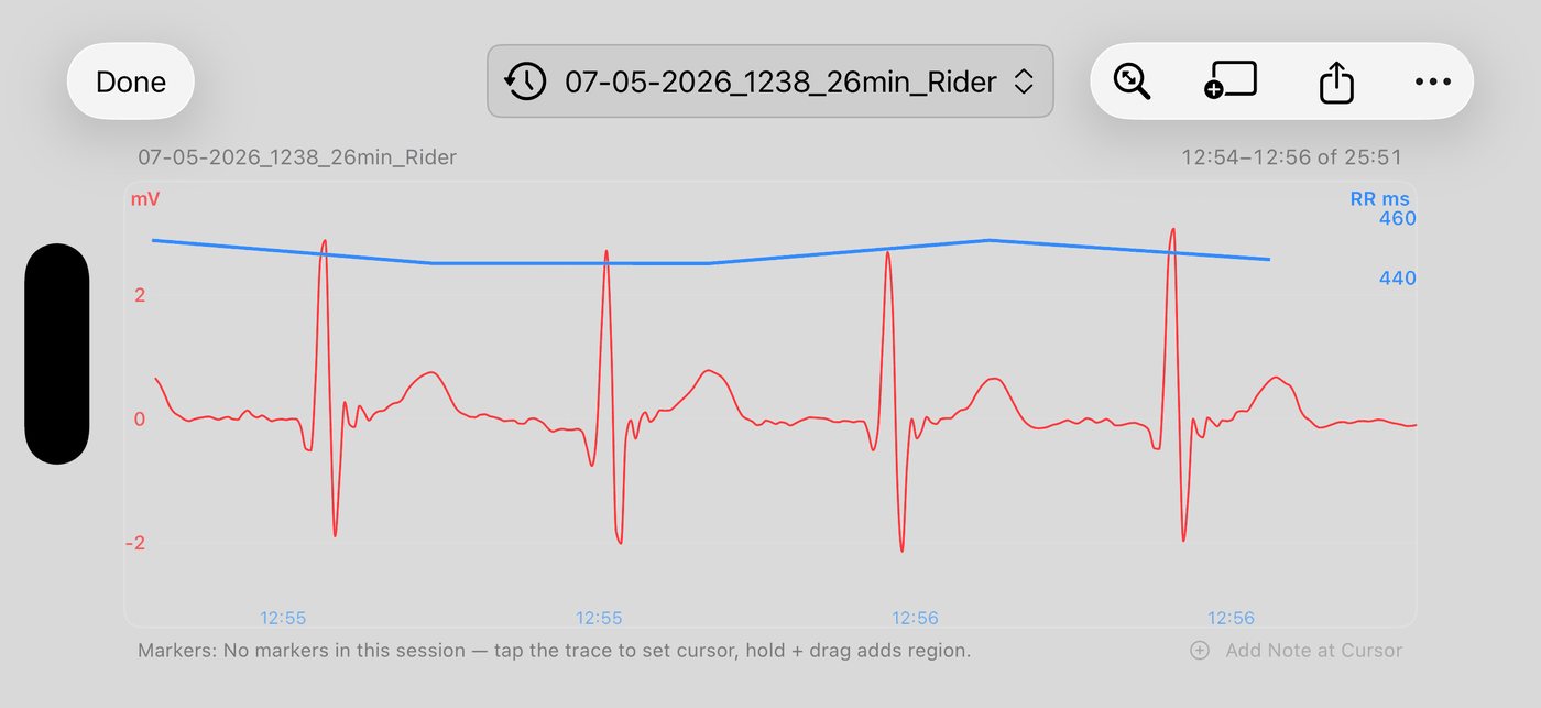 The review screen in landscape: a wide ECG strip with the RR trace above it